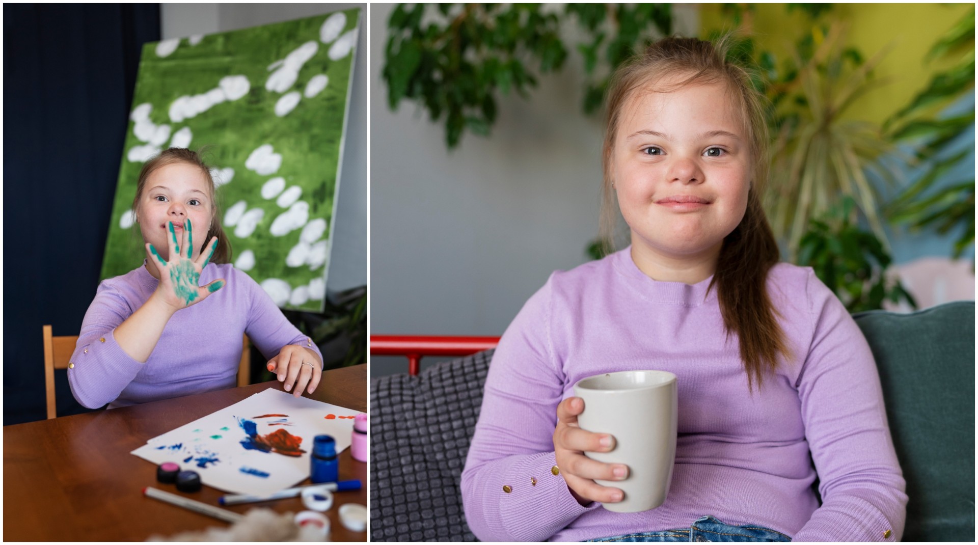 Јапонски научници открија начин за елиминирање на Дауновиот синдром