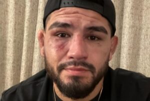 Хернандез по поразот од Стрикленд: Ја потценив ситуацијата