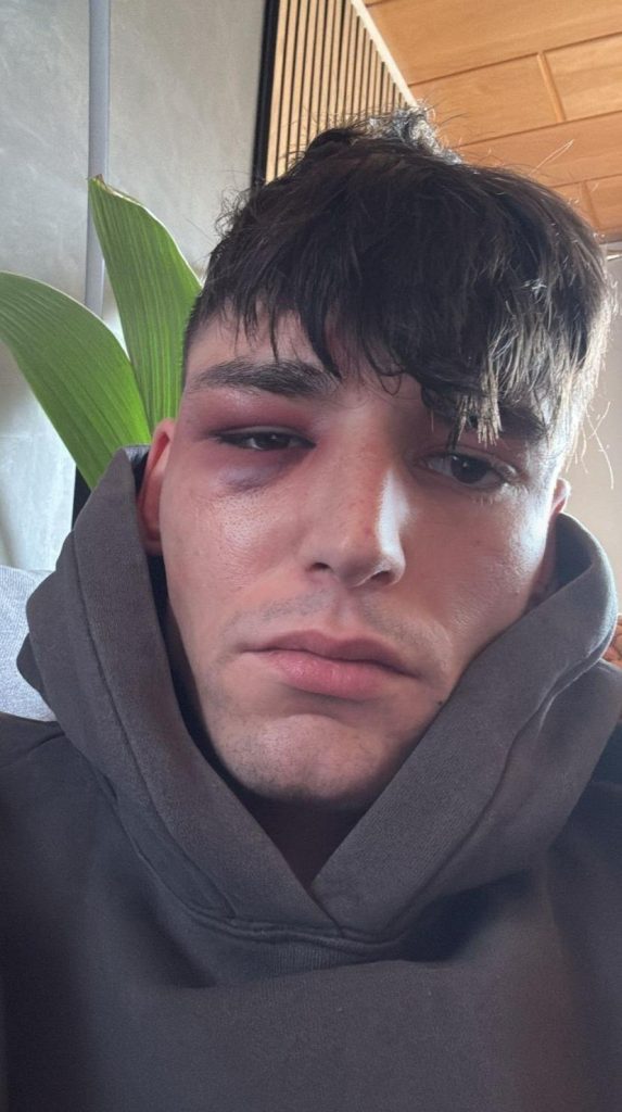 Претепан судијата кој го запроси момчето на Бундес-меч (ФОТО)