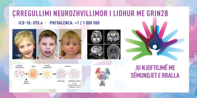 ГИ ЗАПОЗНАВАМЕ РЕТКИТЕ БОЛЕСТИ: GRIN2B-ПОВРЗАНО НЕВРОРАЗВОЈНО НАРУШУВАЊЕ