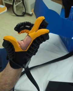 Фондацијата „Заедно за едно“ донираше на ЈЗУ Општа болница Кочани 90 комплети ракавици за пасивна рехабилитација