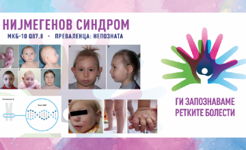 Ги запознаваме ретките болести 2026: НИЈМЕГЕНОВ СИНДРОМ НА РАСКИНУВАЊЕ