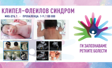 Ги запознаваме ретките болести: КЛИПЕЛ–ФЛЕИЛОВ СИНДРОМ