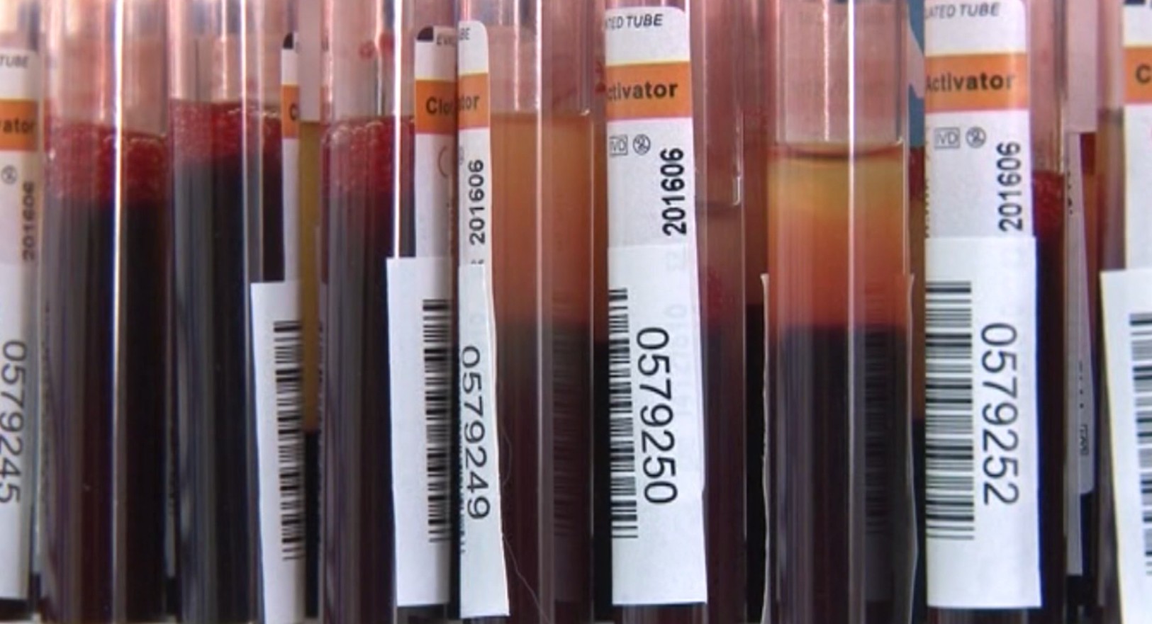 Рекорден број крводарувања во Штип, лани собрани над 5500 крвни единици