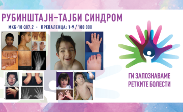 Ги запознаваме ретките болести: РУБИНШТАЈН–ТАЈБИ СИНДРОМ