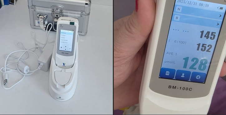 Преку донација за прв пат на Клиниката за детски болести е обезбеден Билирубинометар