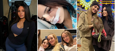 Скандалозната сестра на Луна Џогани си направи пластична операција на носот - Се снима директно од болница