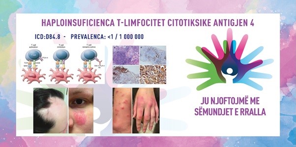 ГИ ЗАПОЗНАВАМЕ РЕТКИТЕ БОЛЕСТИ: ЦИТОТОКСИЧЕН Т-ЛИМФОЦИТЕН АНТИГЕН 4 ХАПЛОИНСУФИЦИЕНЦИЈА