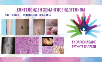 Ги запознаваме ретките болести: ЕПИТЕЛОИДЕН ХЕМАНГИОЕНДОТЕЛИОM