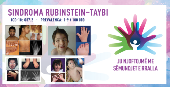 ГИ ЗАПОЗНАВАМЕ РЕТКИТЕ БОЛЕСТИ: РУБИНШТАЈН–ТАЈБИ СИНДРОМ