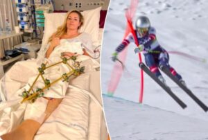 Вон испрати порака по третата операција, објави и „страшна“ фотографија