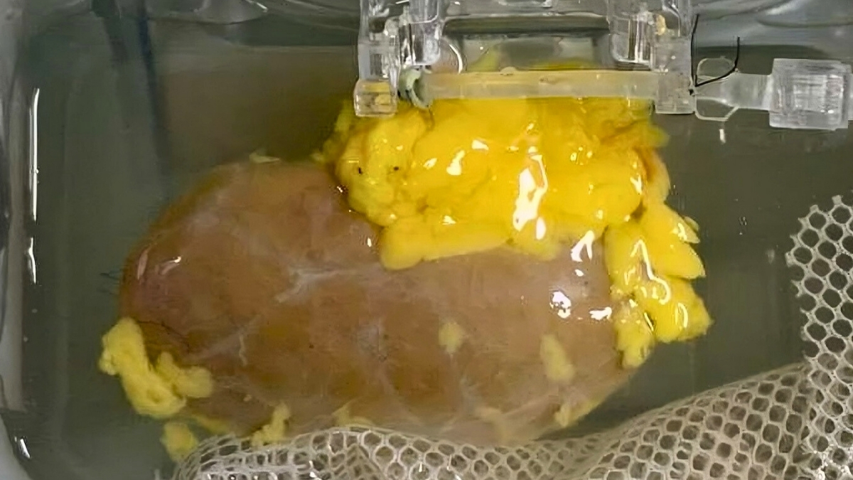 Научно чудо: Светски научници создадоа „универзален“ бубрег што може да се пресади на секој, без оглед на крвната група – може да спаси илјадници животи