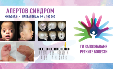Ги запознаваме ретките болести: АПЕРТОВ СИНДРОМ