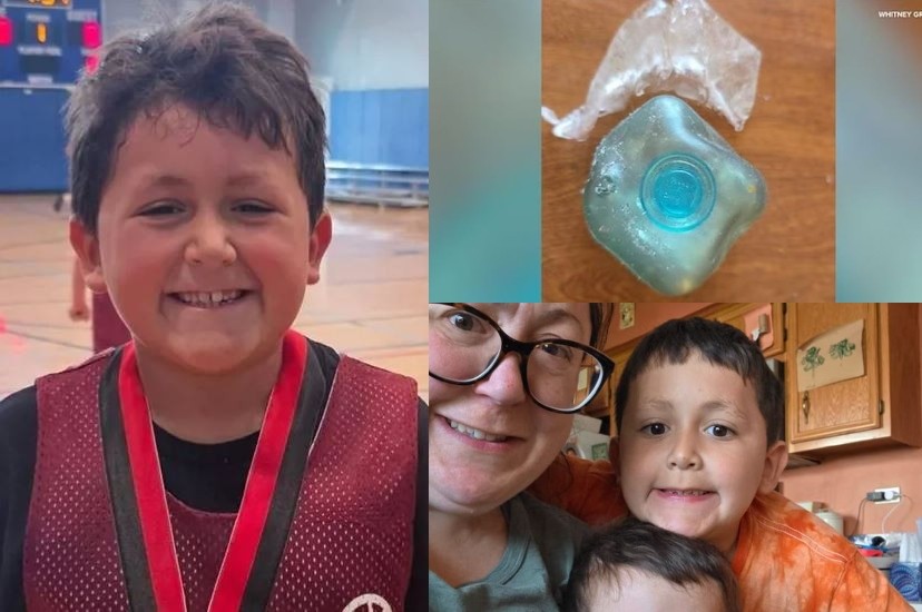 Морничави фотографии: Момче пробало популарен тренд со играчка и микробранова печка, сега има сериозни последици по здравјето