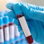 Секоја крвна група е посклона кон одредени болести: Прочитајте која