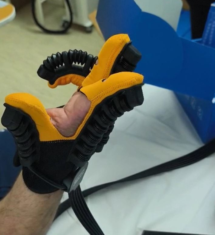 Донација за ЈЗУ Општа болница Кочани од 90 комплети ракавици за пасивна рехабилитација