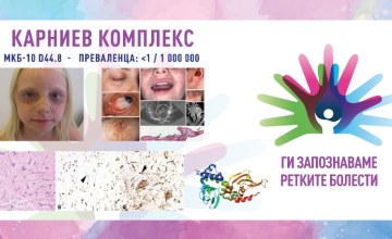 Ги запознаваме ретките болести: КАРНИЕВ КОМПЛЕКС