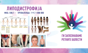 Ги запознаваме ретките болести: ЛИПОДИСТРОФИЈА