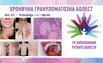 Ги запознаваме ретките болести: ХРОНИЧНА ГРАНУЛОМАТОЗНА БОЛЕСТ