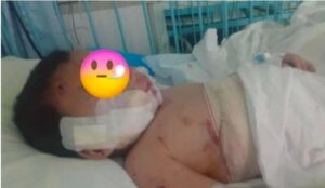 (Видео) Тешка е здравствената состојба на двегодишникот искасан од куче