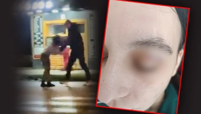 МАМО, НЕ МОЖАМ ПОВЕЌЕ ДА ТРПАМ ЌОТЕК: Се огласи 25 годишната Катарина по видеото на кое нејзиниот партнер ја тепа среде улица (ВИДЕО)