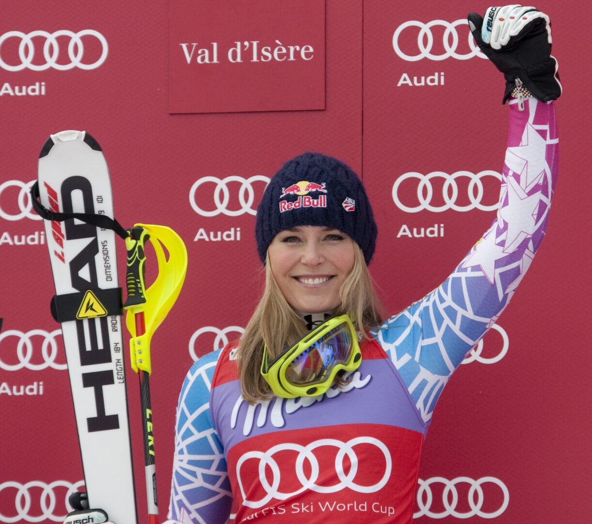 Хирург за Вон: Фрактурата не е санирана, приоритет е да се спаси ногата