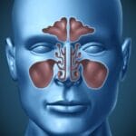 Четири клучни знаци дека настинката се претворила во инфекција на синусите, открива ринолог