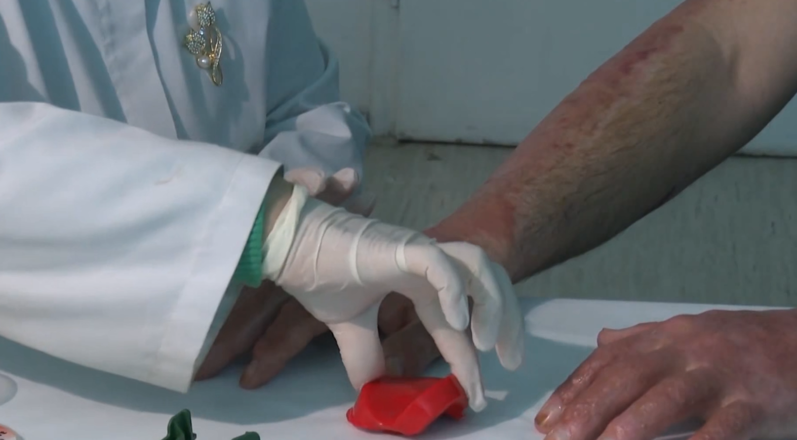 Пациентите од „Пулс“, чекор по чекор до целосно закрепнување