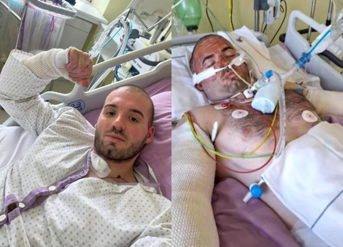 Преживеан од трагедијата во „Пулс“: „10 дена кома и месец борба, животот е кревок, секој ден е подарок“