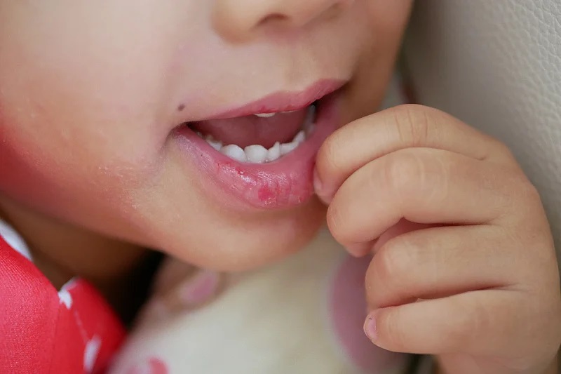 Алиу: Македонија е меѓу најдобрите земји во намалување на смртноста кај децата