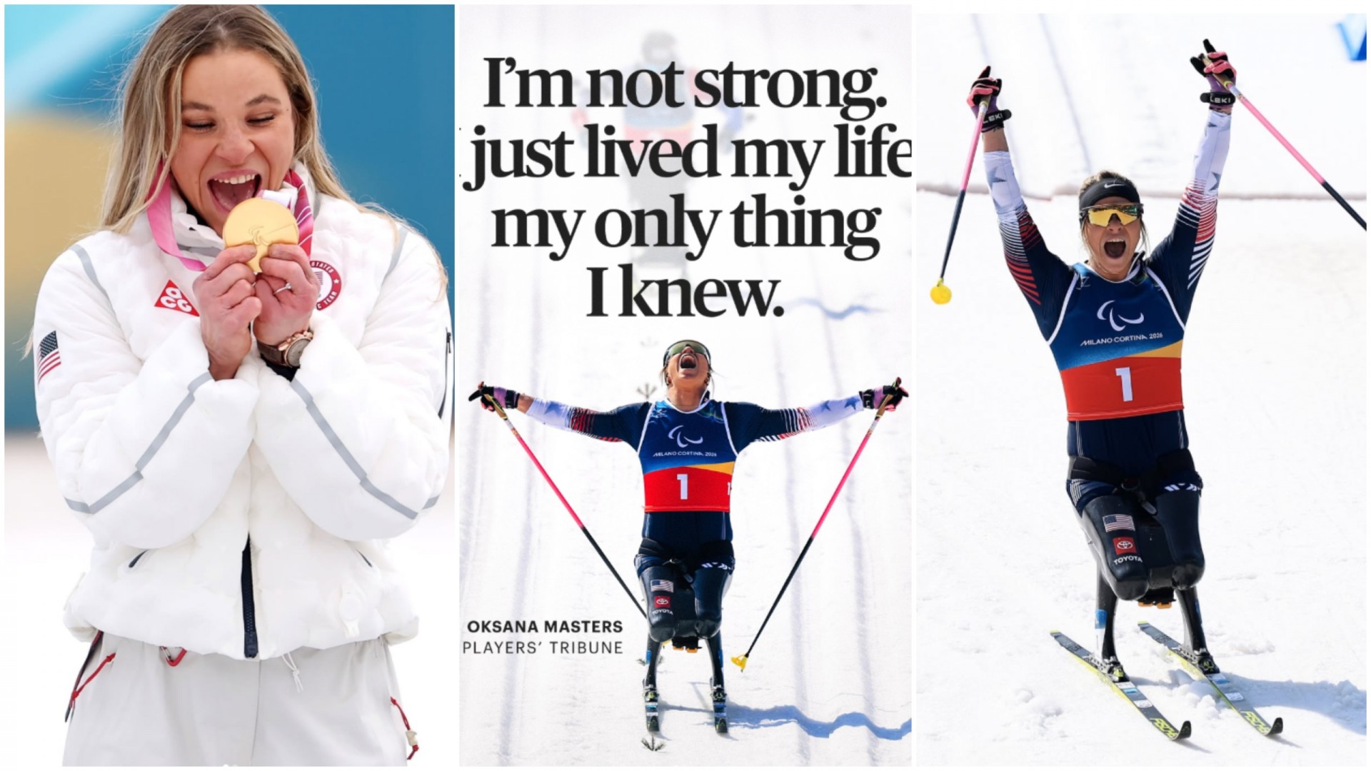 Родена со 6 прсти, без палци-сега е шампион: Знаете ли што е Чернобилско срце?