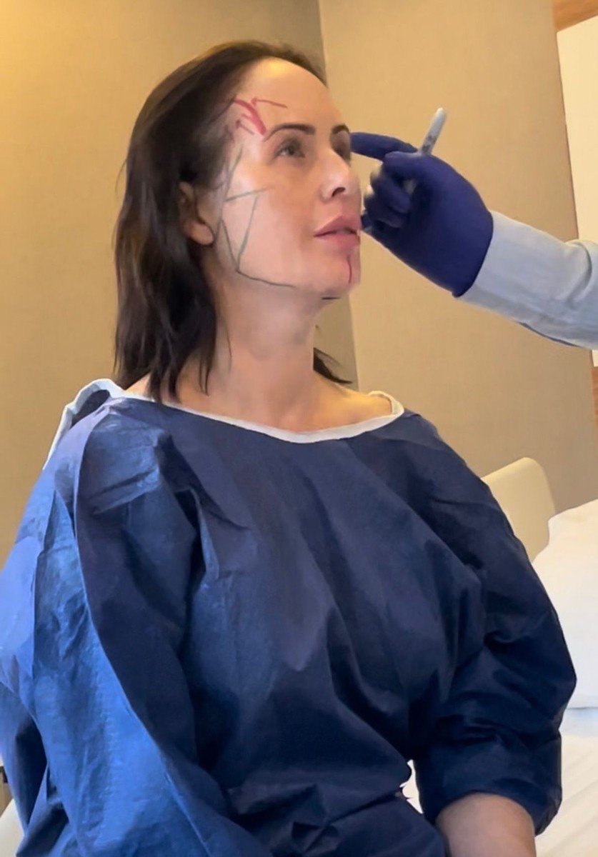 Жена потрошила 12.000 евра и летала 19 часа во авион за лифтинг, а луѓето велат дека изгледа постаро од кога било