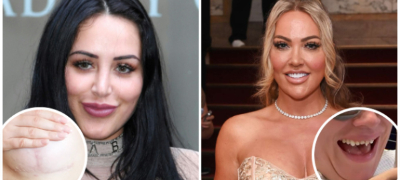 Вистински хорор-приказни од операции и процедури за убавина (направени во непроверени клиники)