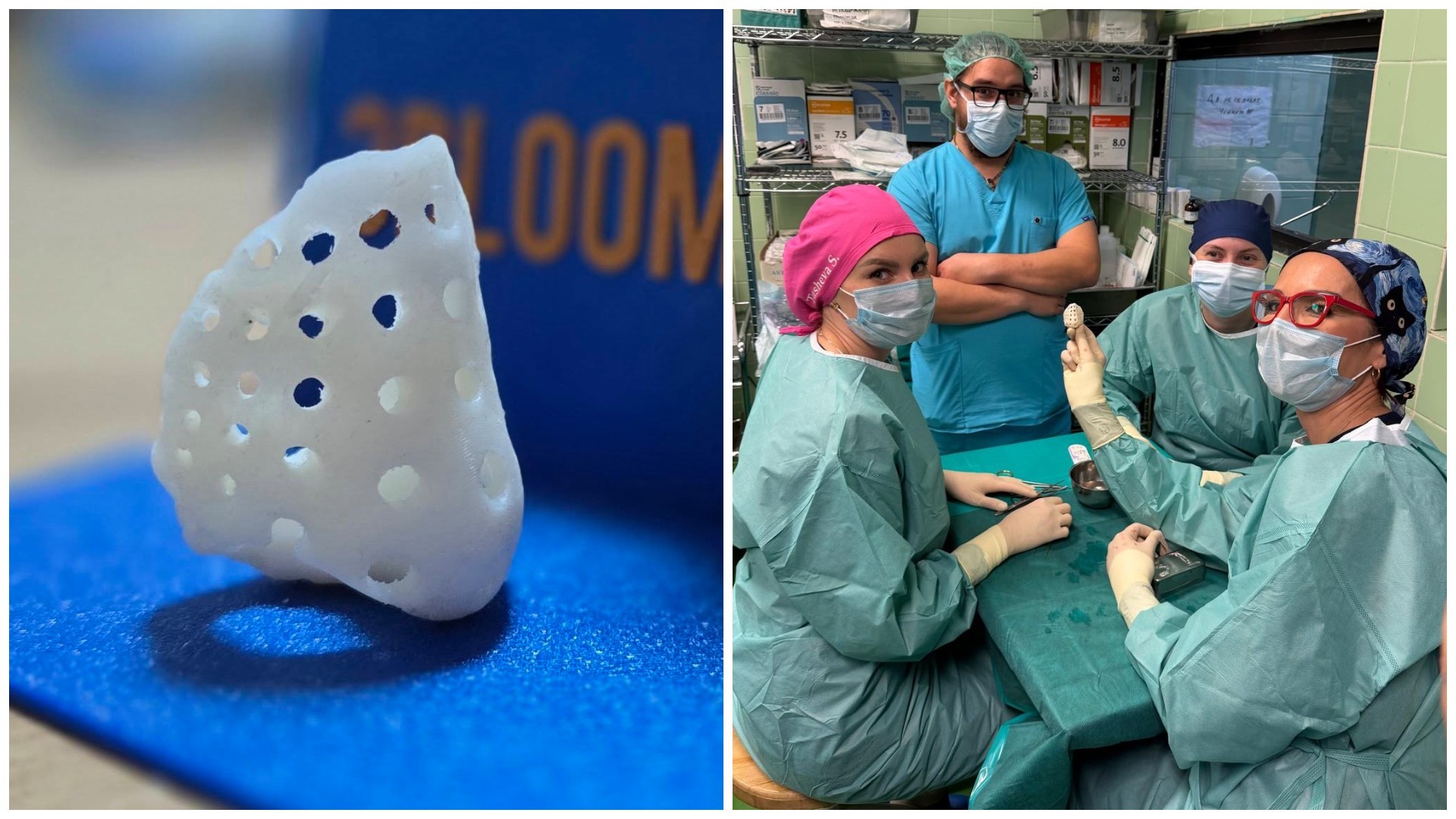 За првпат во Македонија и регионот: Изведена операција со 3Д отпечатен имплант за нос