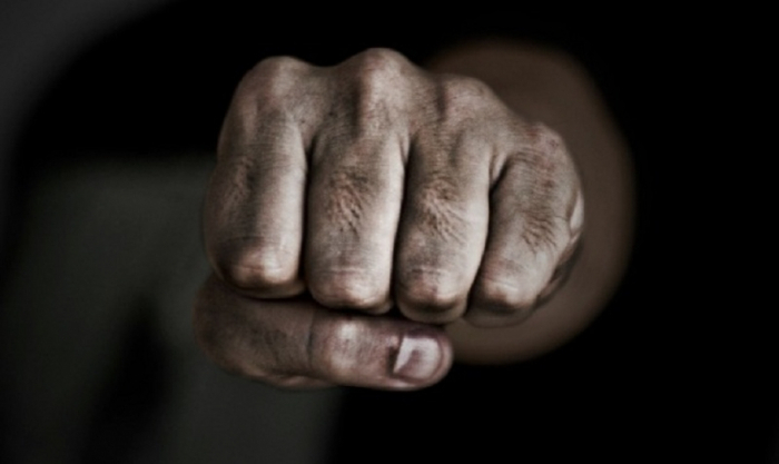 Фудбалски тренер од Куманово нападнат од малолетник од неговиот клуб и неговиот татко