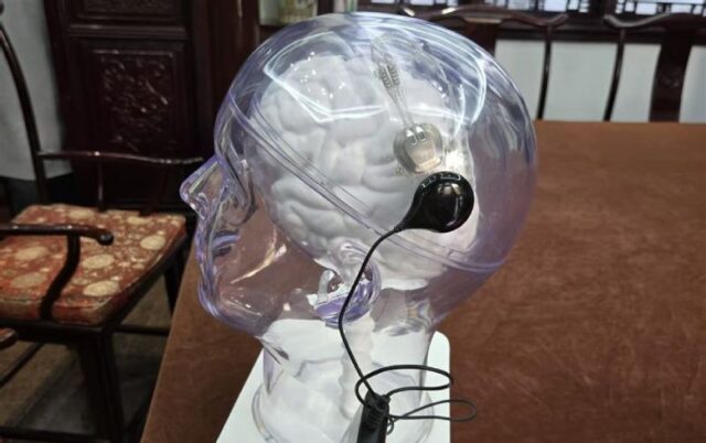 Кина даде зелено светло за првиот мозочен чип за комерцијална употреба