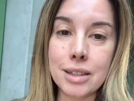 Модринки меѓу градите: Нивес Целзиус го фотографираше своето деколте и ги загрижи сите