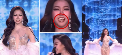 Непријатна сцена: На мисица ѝ испаднаа забните навлаки среде обраќање на сцена (видео)