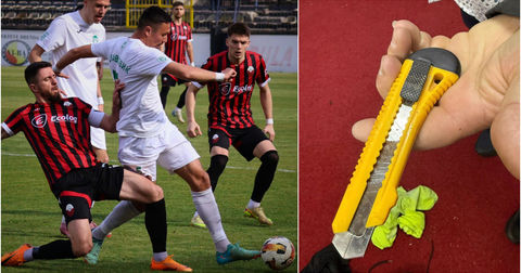 ФФМ откри скандал во Тетово: Кон официјалните лица фрлиле дури и – скалпел!