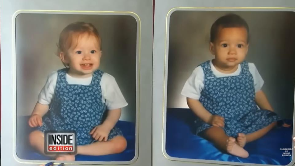 Како изгледаат денес близначките кои го шокираа светот? Нивниот случај е редок, никој не веруваше дека се сестри