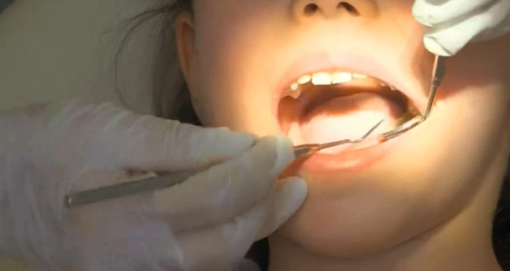 Родители бараат регионални стоматолошки центри за деца со попреченост