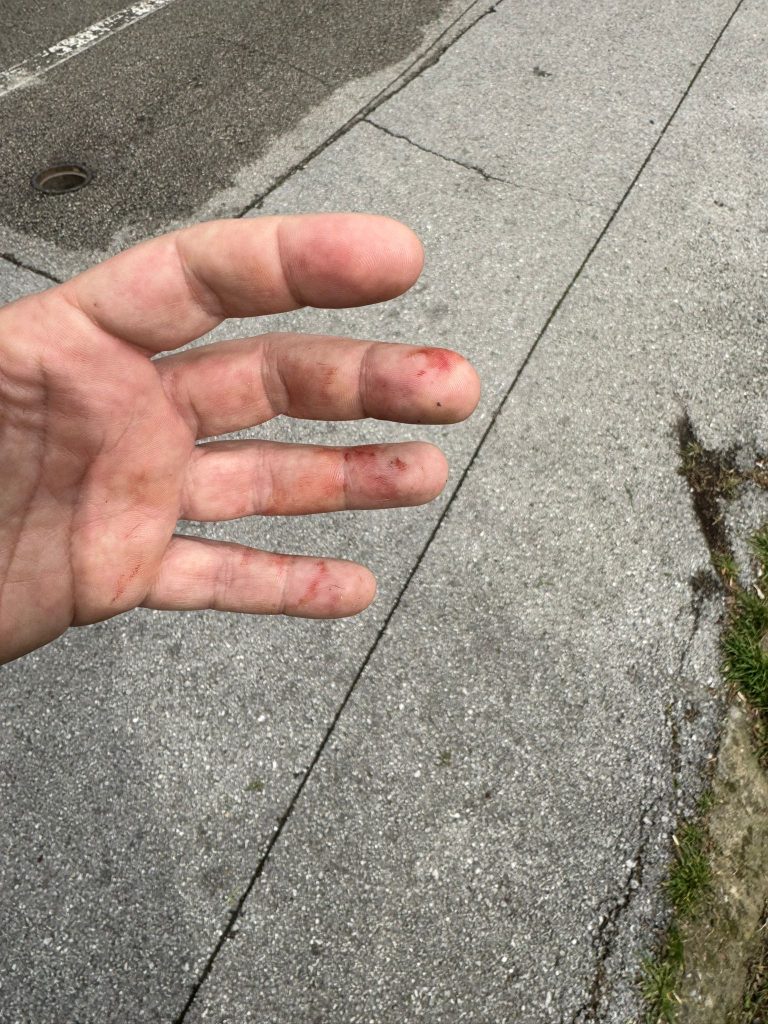 Страв во Карпош: Пит Бул слободно се движи и агресивно искаса минувач