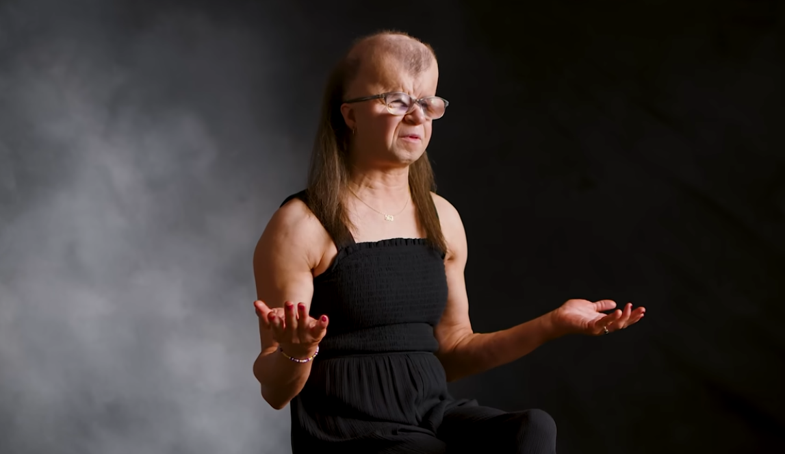 Млада жена со синдром што предизвикува прерана смрт сведочи: „Секој ден го живеам како благослов“