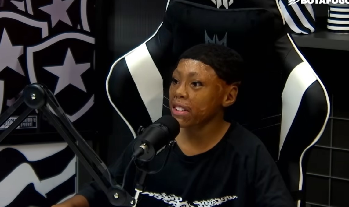 Приказна како за на филм: На една година доживеал страшна несреќа, а сега стана дел од бразилски гигант