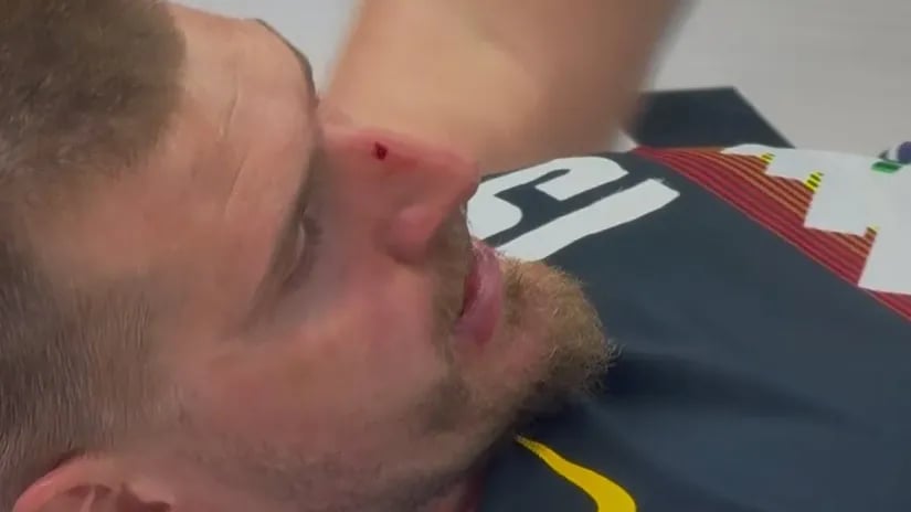 Јокиќ си доби по носот од Вембанјама – потече и крв (ВИДЕО)