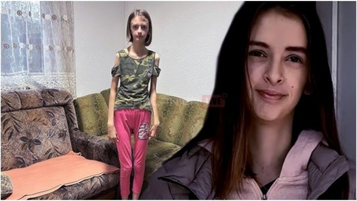 Евреса ја победи тешката болест, тежеше само 35 килограми