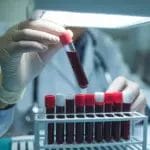 Научниците откриле дека луѓето со оваа крвна група живеат најдолго: Тие ретко заболуваат од сериозни болести и се кандидати да доживеат сто години