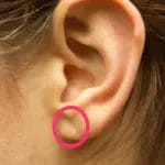 Френков знак – појава на увото која бара проверка на срцето