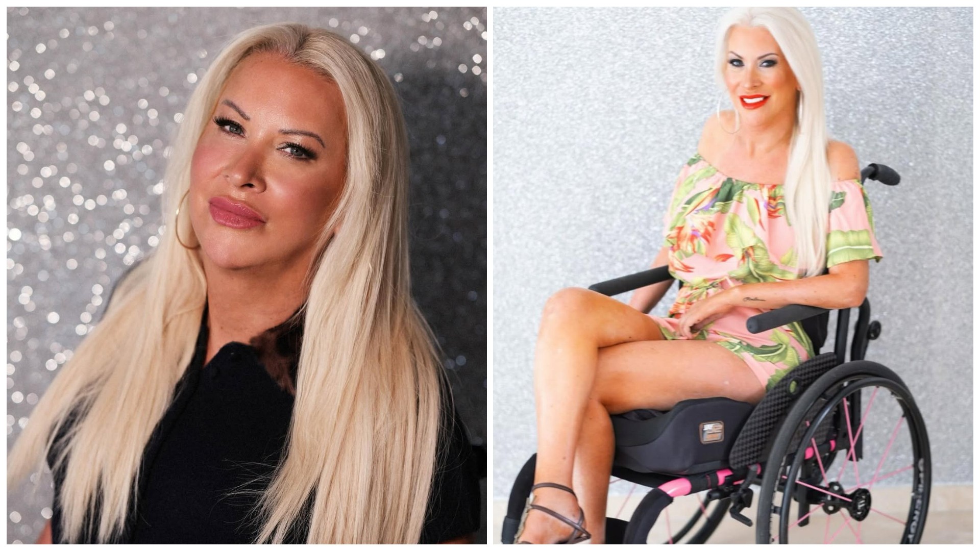 „Една секунда ми го промени животот“ – Жена останала парализирана откако момче паднало од балкон врз неа во дискотека