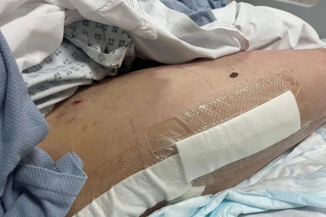 Мотоциклист сподели како изгледа по стравична несреќа на патеката – глетката е ужасна (ФОТО)